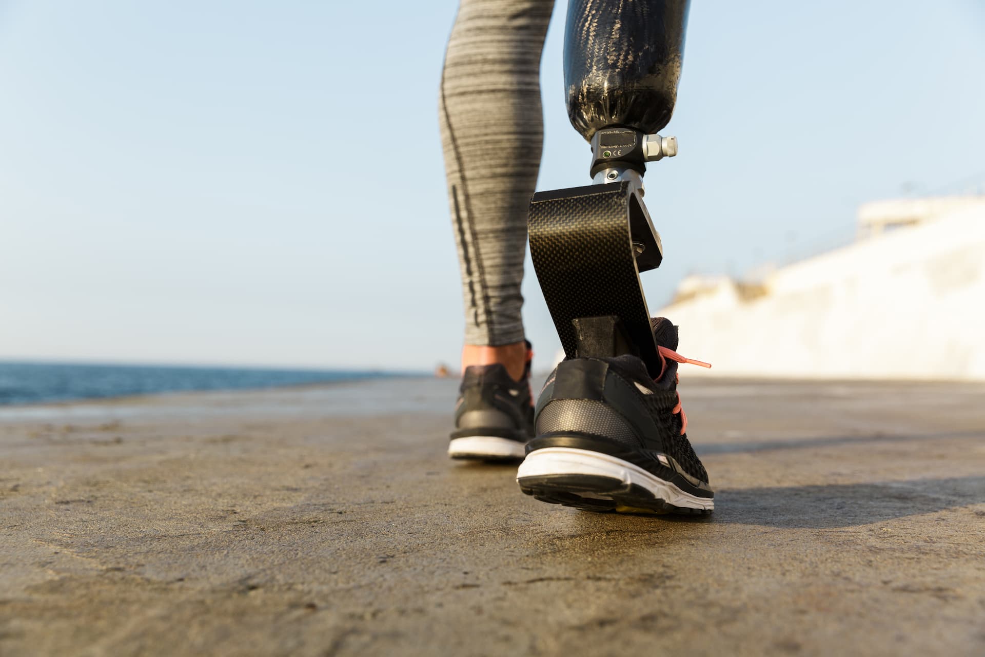 Amputation Injuries