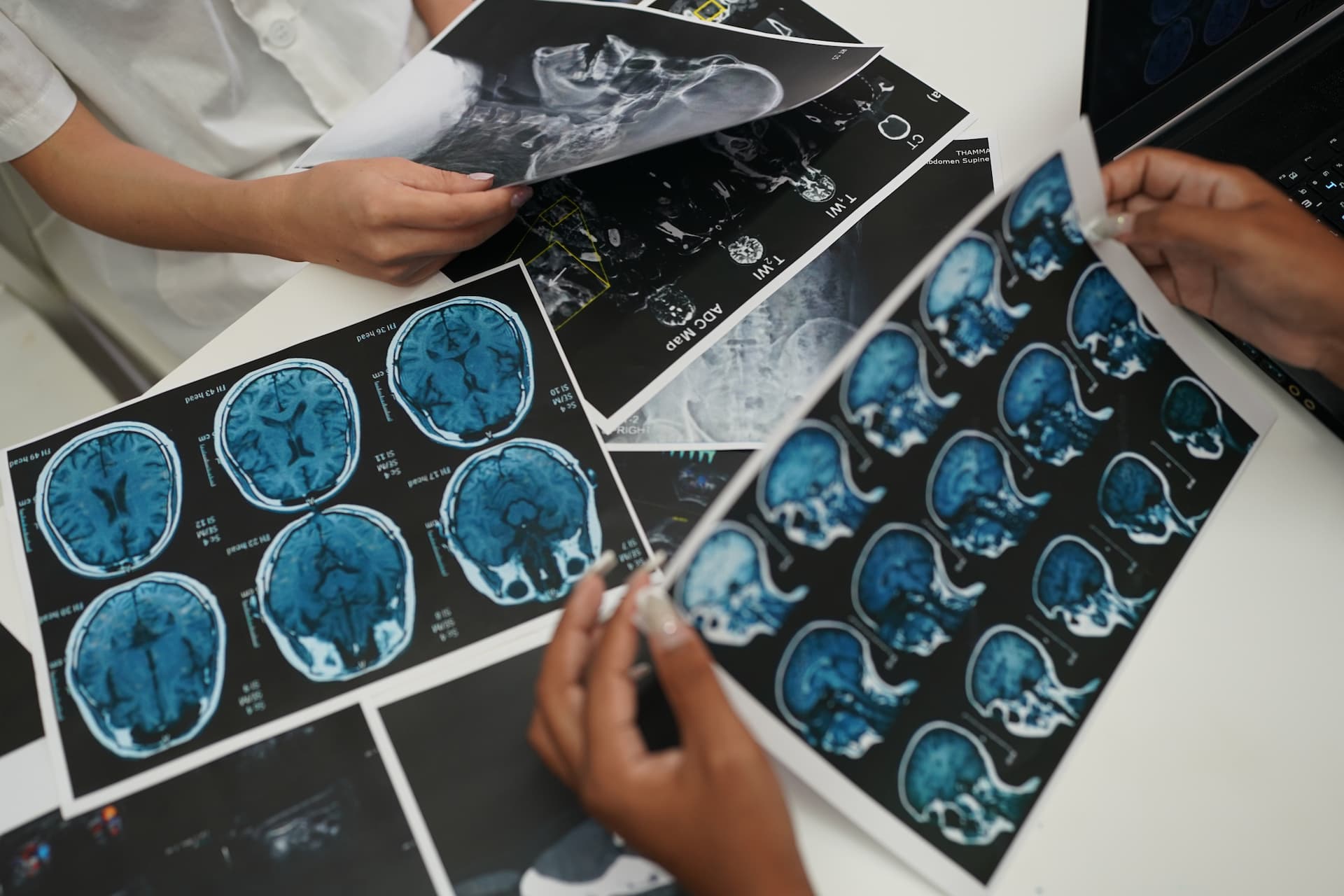 Brain Injury